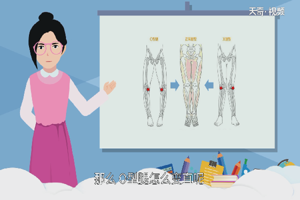 O型腿怎么变直