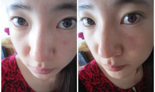 鼻子变挺的方法按摩 鼻子变挺的方法按摩图解