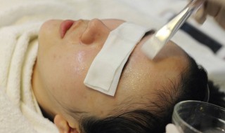 如何改善面部红血丝（如何改善面部红血丝现象）