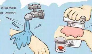 被烫了怎么办（舌头被烫了怎么办）