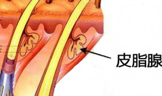 皮脂腺分泌旺盛怎么办（皮脂腺旺盛怎么解决）