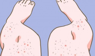 鸡皮肤怎么快速消除（鸡皮肤怎么快速消除掉）