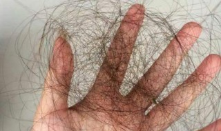 防脱发小窍门（防脱发小窍门有哪些）