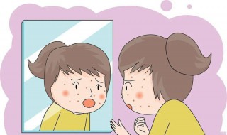 怎么正确祛除痘痘 怎么样祛除痘痘