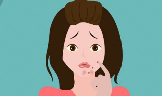 红色痘印怎么去除 留下的红色痘印怎么去除