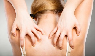 晒脱皮了怎么办 晒脱皮了怎么办才能快速恢复