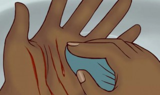 怎么处理伤口 发炎化脓怎么处理