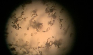 户尘螨是什么东西（户尘螨是什么?）