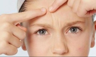 长痘的原因都有些什么 长痘的原因都有哪些