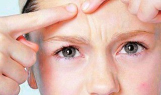 痘痘能不能去挤（痘痘能不能去挤痘印）