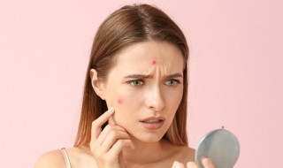 痘痘要怎么处理（痘痘要怎么处理才不会留痘印）