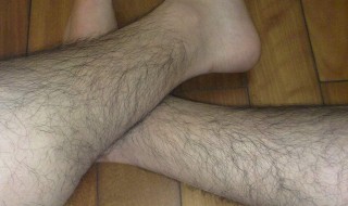 腿毛要怎么去掉 腿毛要怎么去掉男