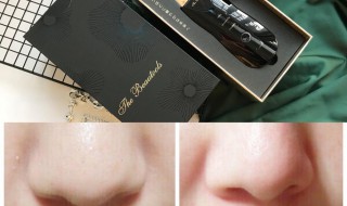 黑头一直不挤会怎样 挤黑头粉刺清理解压视频