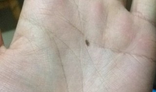 掌心有痣代表什么（女人左手掌心有痣代表什么）