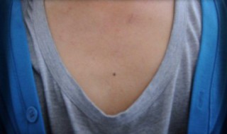 胸前有痣代表什么（胸前有痣代表什么前世）