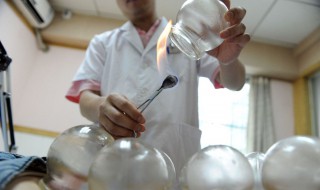 拔罐出水泡怎么回事（真空拔罐出水泡怎么回事）