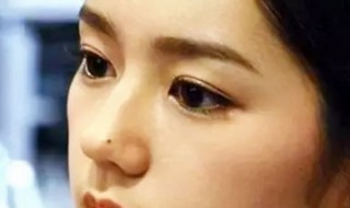 人脸上哪些痣不能点掉 人脸哪些痣不能取