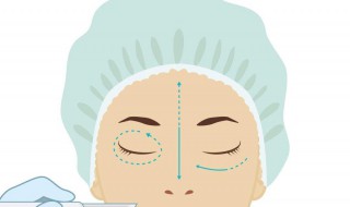 怎样能除去眼袋（怎样能除去眼袋上的皱纹）