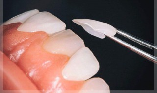 美白牙齿最有效的方法（牙齿变白的10个小妙招）