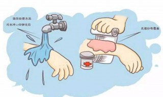 烫伤的处理方法 烫伤后擦什么药好得快