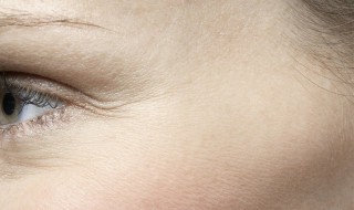 减少脸部皱纹的方法 怎样做才能减少脸上的皱纹