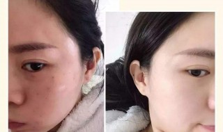 天生的黑皮肤如何变白 天生的黑皮肤如何变白用什么产品