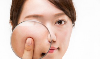 改善毛孔粗大的小窍门 收缩毛孔最佳方法