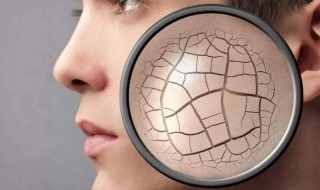 皮肤干燥的原因有哪些（皮肤干燥的原因有哪些?）