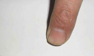 墙面发霉发臭怎么办