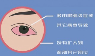 右眼跳代表什么（右眼跳代表什么预兆女）