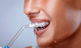 冲牙器正确使用方法（冲牙器正确使用方法视频）