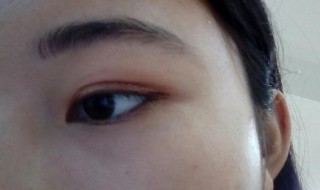 怎样贴双眼皮贴（怎样贴双眼皮贴最隐形）