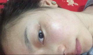 斑怎样才能清除（斑怎么才能去掉）