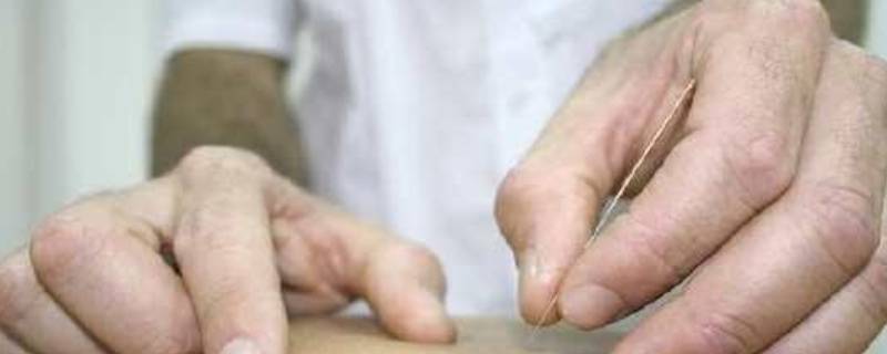 针灸所用的九针是谁发明的 针灸所用的九针是谁发明的