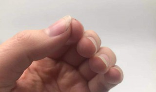 手指甲没有月牙正常吗（两岁宝宝手指甲没有月牙正常吗）