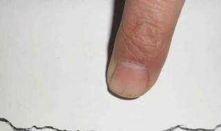 白墙发霉发黑怎么处理 白墙发霉发黑如何处理