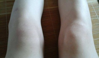 让膝盖变瘦的方法 让膝盖变瘦的方法图片