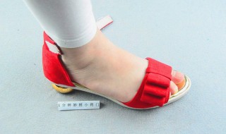 脚掌底摩擦起包怎么处理 脚底板摩擦起泡了怎么处理