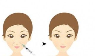 怎样消灭法令纹 怎么消灭法令纹