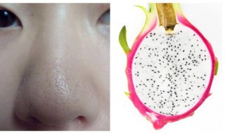 怎样消除黑头（怎样去除黑头和缩小毛孔）