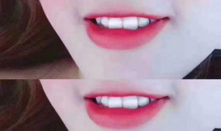 美牙仪使用方法 美牙仪使用方法图片