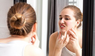 大粉刺痘痘怎么处理 大粉刺是怎么回事