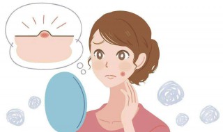 痘痘洗脸洗破了怎么办（洗脸的时候不小心把痘痘洗破怎么办）